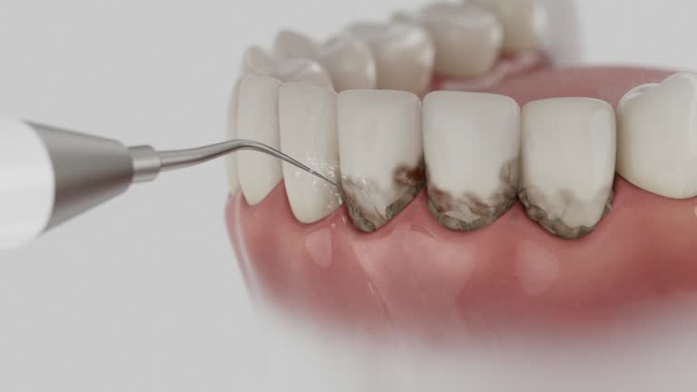 Reliable Wisdom Tooth Removal contractor in Randolph County County, GA by Dentist Open Now